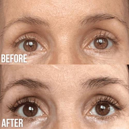 lash lifting before and after