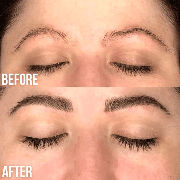 lifted eyebrows before and after