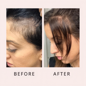 Luxe Hair Growth Serum